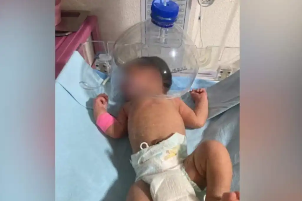 Atienden a bebé con botella de plástico en Hospital General de Macuspana, Tabasco